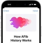 Apple Watch AFib History اکنون در هند در دسترس است.