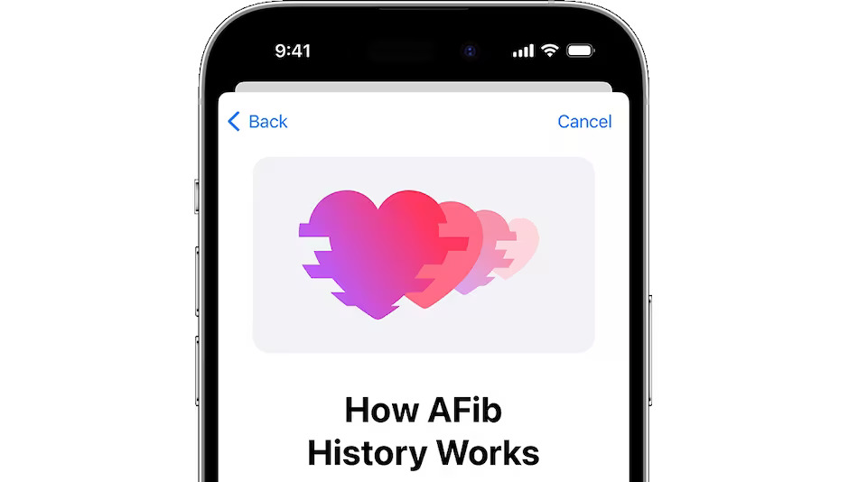 Apple Watch AFib History اکنون در هند در دسترس است.