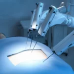 اولین جراحی پیوند کبد رباتیک در بیمارستان فوق تخصصی DPU