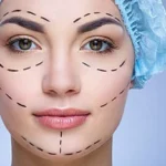 جراحی زیبایی