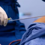 جدیدترین تکنولوژی پیکرتراشی بدن