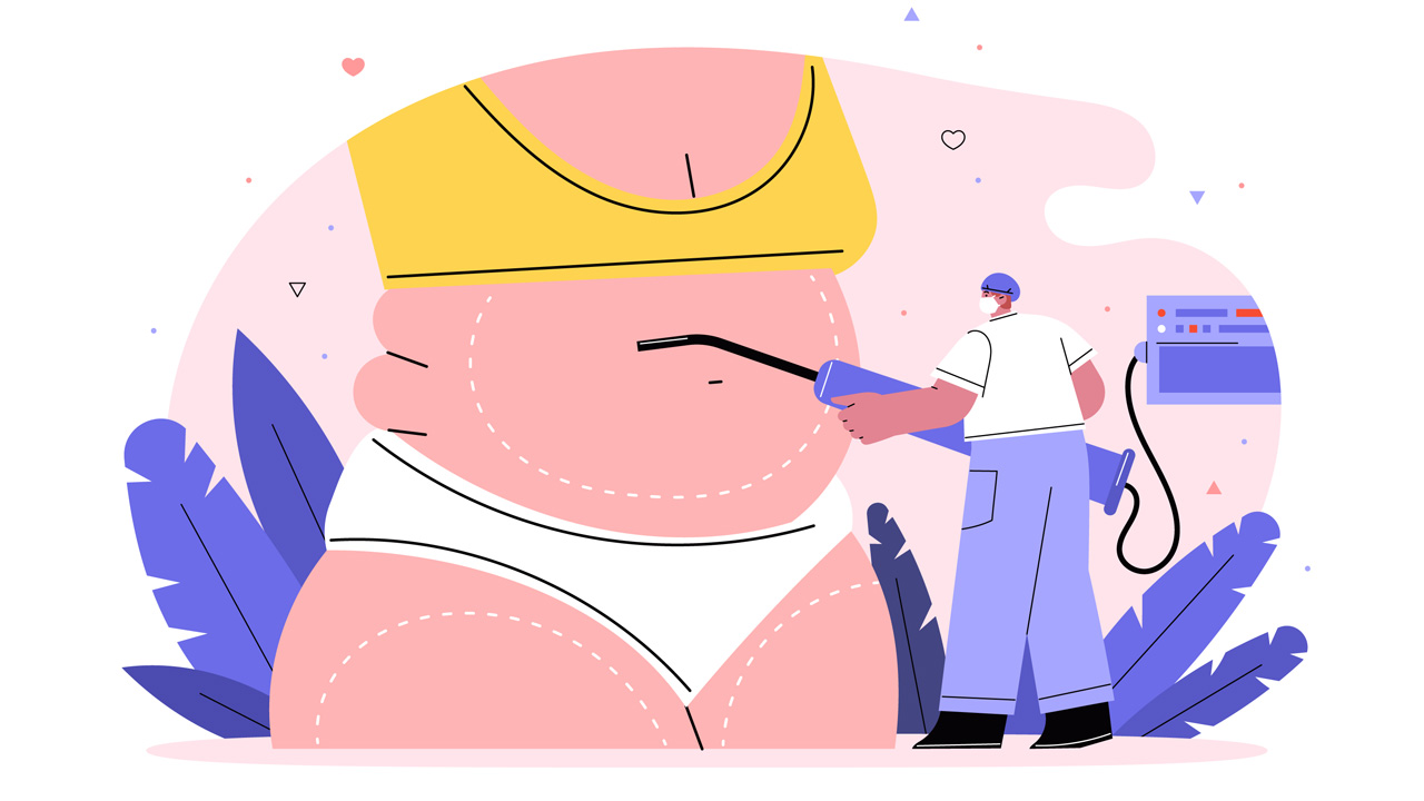 مزایای لیپوماتیک