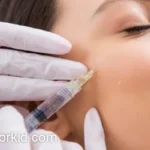 بهترین مرکز تزریق فیلر در غرب تهران